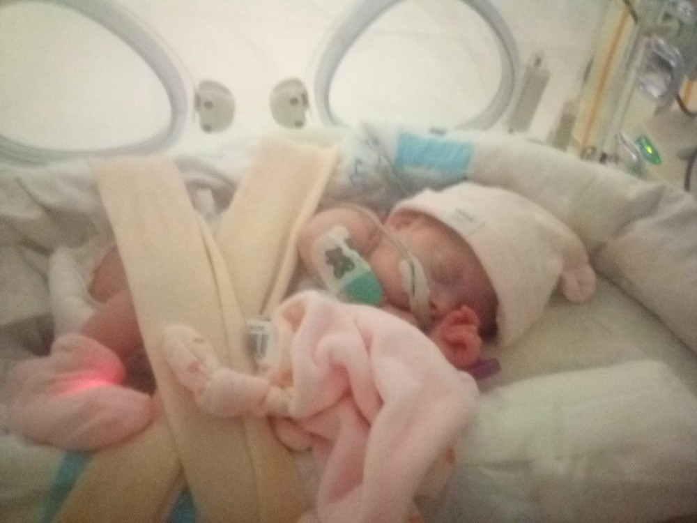 El milagro de Ecaterina: el bebé más prematuro del Clínico