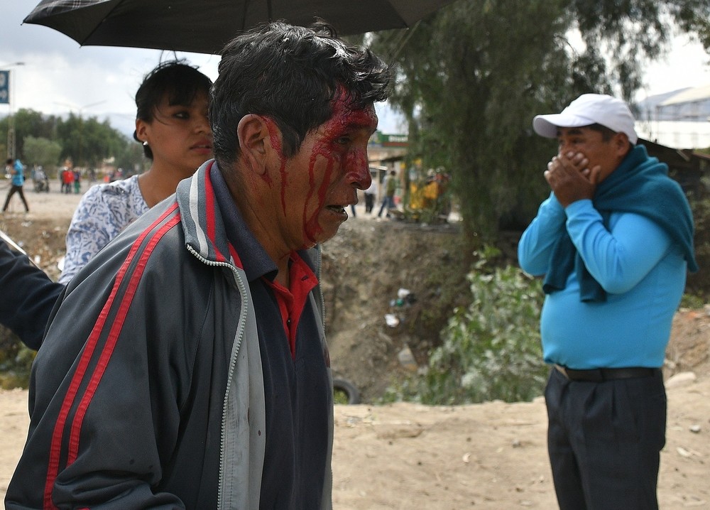 La Defensoría cifra en más de 300 los heridos en Bolivia